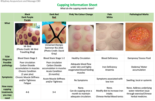 Cupping Info Sheet