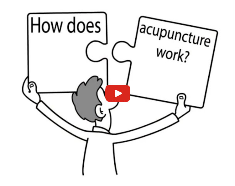Video how does Acupuncture works